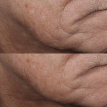 Load image into Gallery viewer, Obagi elastiderm lift and sculpt