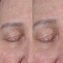 Load image into Gallery viewer, Obagi elastiderm lift and sculpt