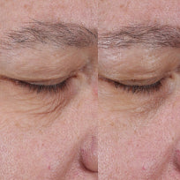 Load image into Gallery viewer, Obagi elastiderm lift and sculpt