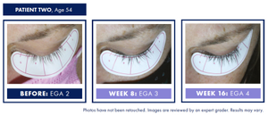 Obagi Nu-Cil eyelash enhancing serum - Arden Skincare 