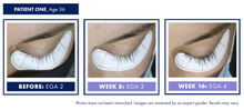Load image into Gallery viewer, Obagi Nu-Cil eyelash enhancing serum - Arden Skincare 