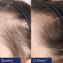 Load image into Gallery viewer, Arden Skincare Obagi NU-Cil Biostim scalp serum for hair growth, showing a clear bottle with the serum inside.