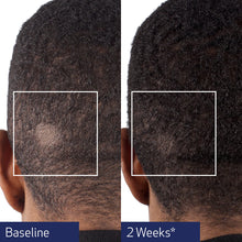 Load image into Gallery viewer, Arden Skincare Obagi NU-Cil Biostim scalp serum for hair growth, showing the serum bottle and applicator brush.