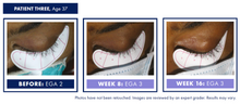 Load image into Gallery viewer, Obagi Nu-Cil eyelash enhancing serum - Arden Skincare 