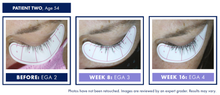 Load image into Gallery viewer, Obagi Nu-Cil eyelash enhancing serum - Arden Skincare 